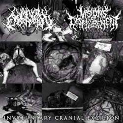 Chainsaw Castration : Involuntary Cranial Excision